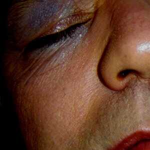 username, area photo